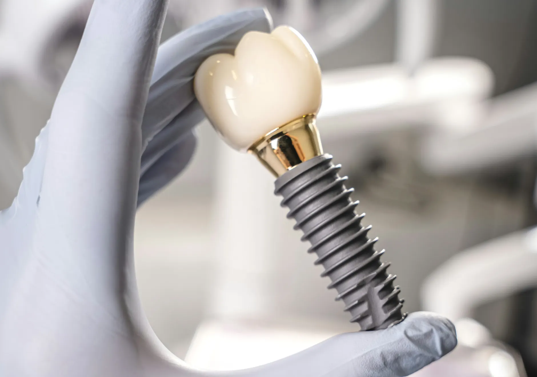 A gloved hand holding an implant post with its ceramic crown
