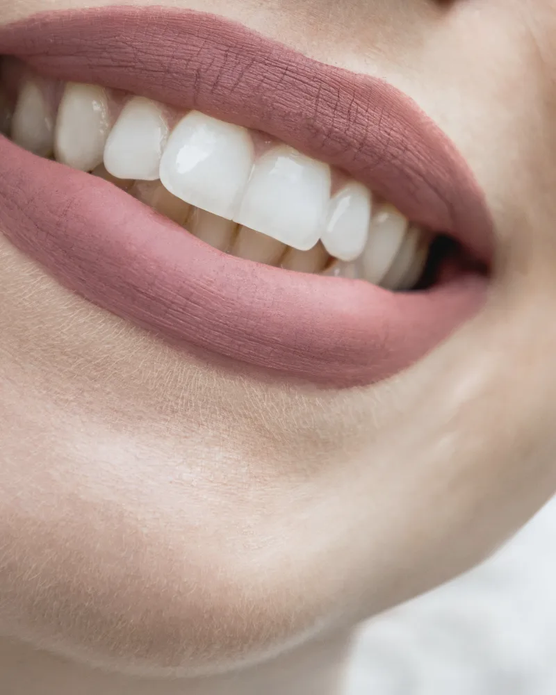 Close-up of a smile with even, natural white teeth